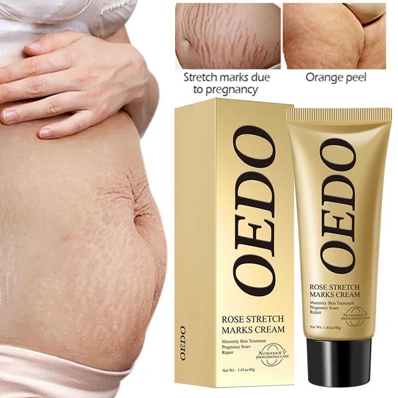 

Removes Stretch Mark Cream To Remove Postpartum Obesity Pregnant Women Repair Anti-Aging Winkles Firming Body Cream Skin Care