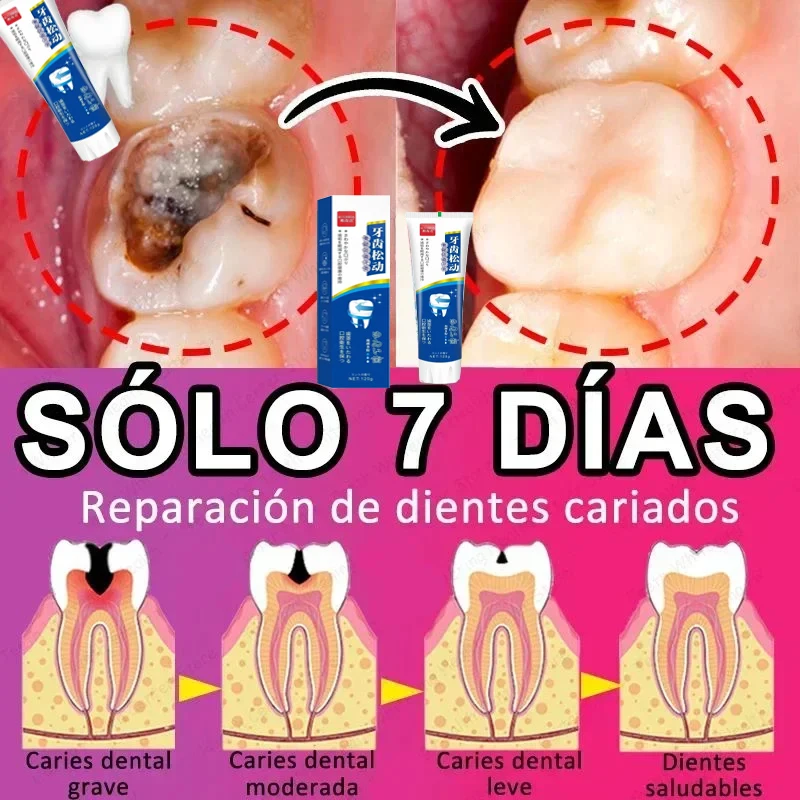 Quick Repair Cavities Caries Probiotic Toothpaste Clean Whiten Remove Yellow Plaque Protect Gum Reduce Tooth Stains Fresh Breath