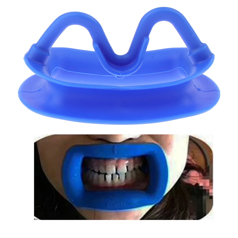 

1Pcs Silicone Mouth Opener Dental Orthodontic Cheek Retractor Tooth Intraoral Lip Cheek Retractor