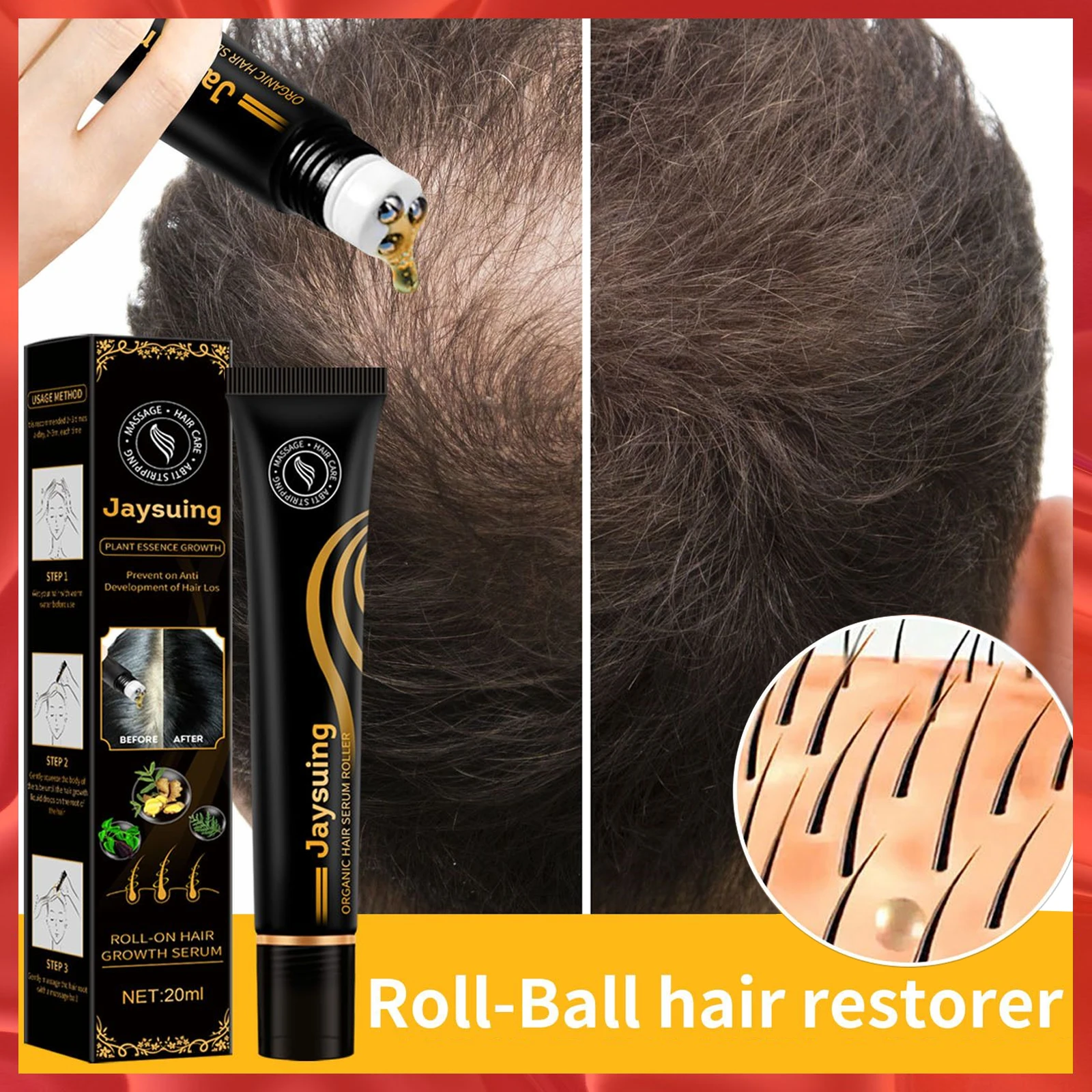 Roll-on Hair Tonic Massage Head Hair Conditioner Massage Nourish  Anti-dehydratio Growth Thick Hair Serum Tonic Hair Essence - Hair Loss  Product Series - AliExpress