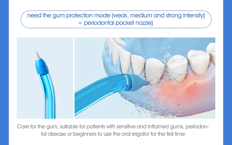 Xiaomi SOOCAS W3 Pro Water Flosser Teeth 4 Type Nozzle Cleaner description image 8