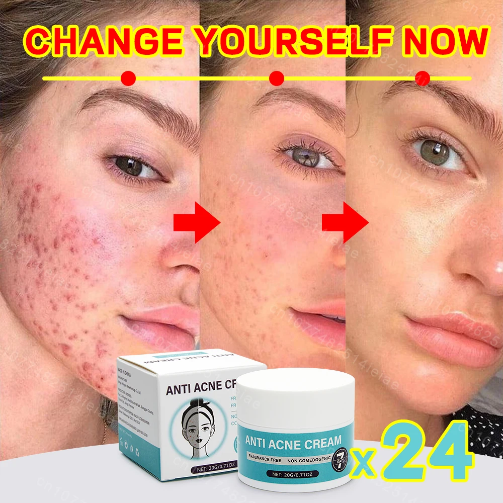 Face Cream Shrink Pores Repair
