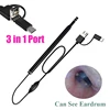 Medical USB Ear Cleaning Tool HD Visual Earwax Spoon Earpick Otoscope with Mini Camera Pen Ear Care In-ear Cleaning Endoscope 1