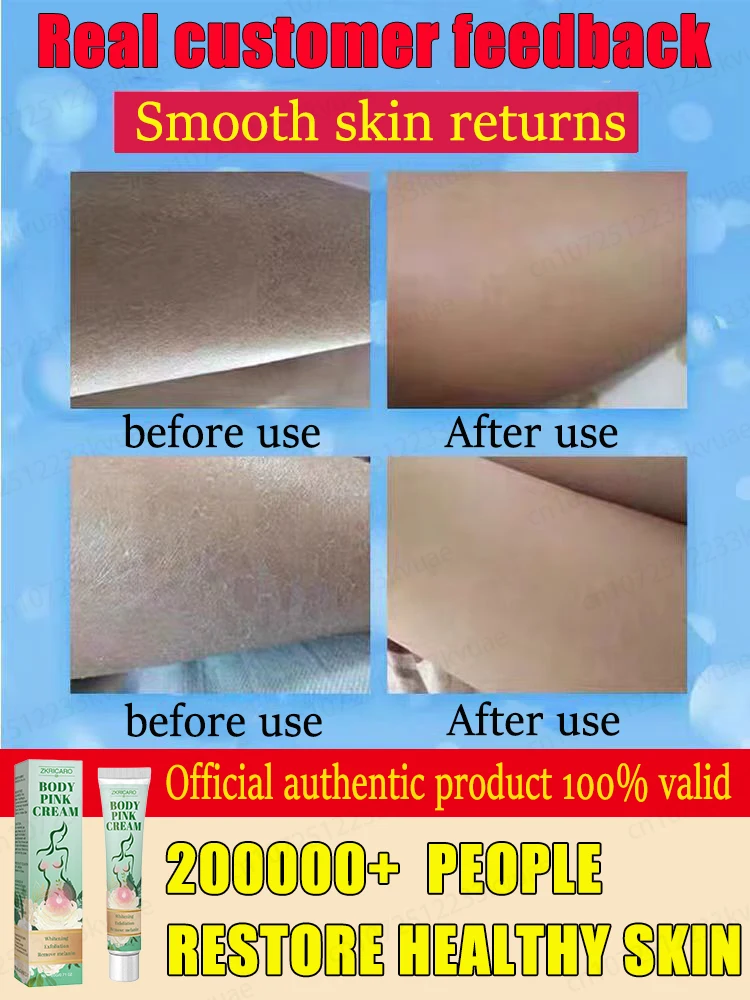 Body lotion solves strawberry legs and clears acne