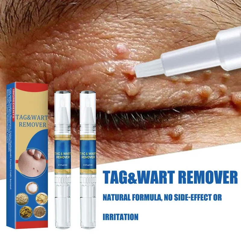 

Warts Remover Liquid Antibacterial Ointment Wart Treatment Cream Skin Tag Remover Herbal Extract Corn Plaster Warts Ointment