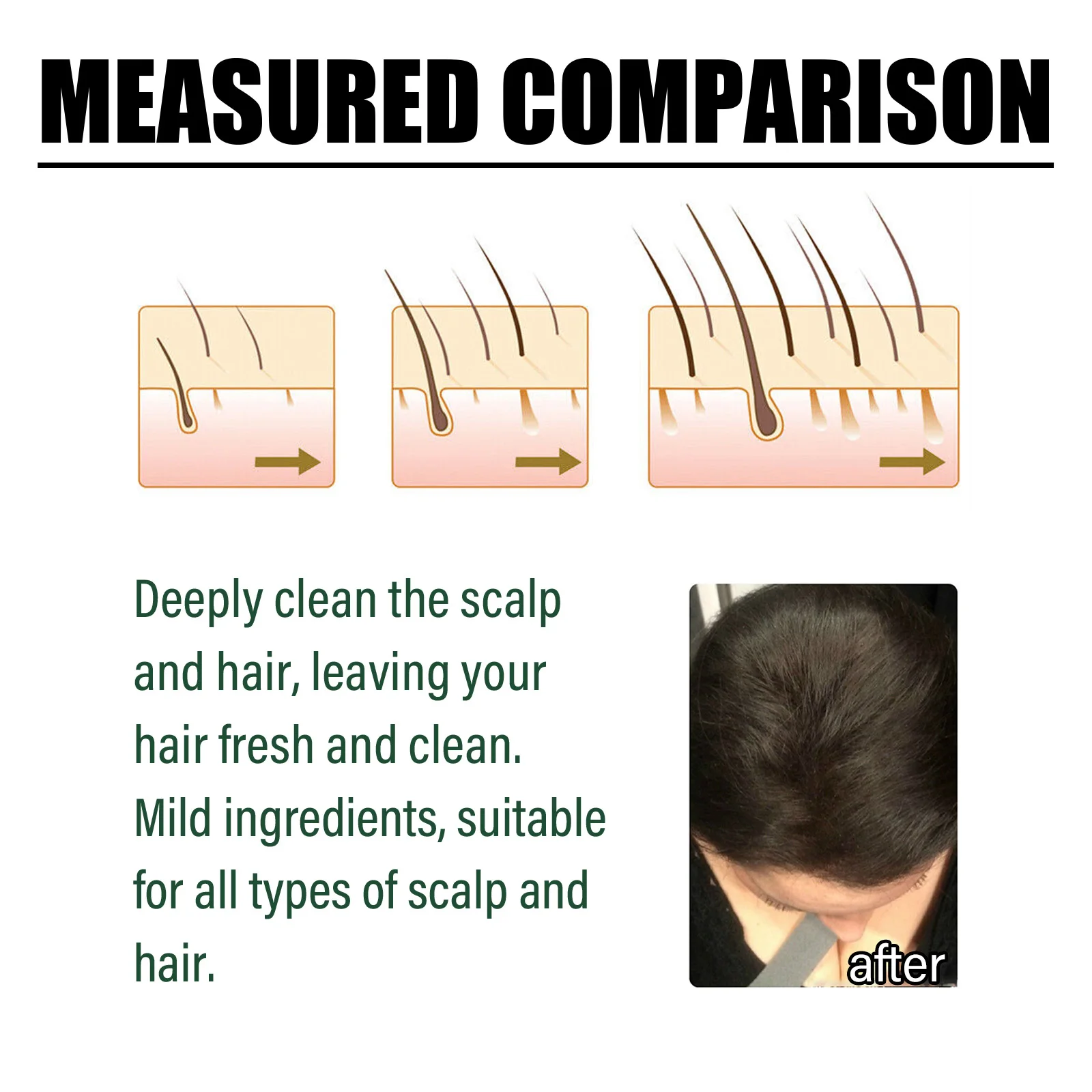 Hair Shampoo For Anti-Dandruff Oil Control Fluffy Refreshing Deep Cleansing Scalp Improve Dryness Frizz Smooth Hair Care Product 5