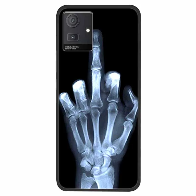 Cubot Note 50 Animal Design TPU Silicone Phone Case - Shockproof Wolf Pattern Protector