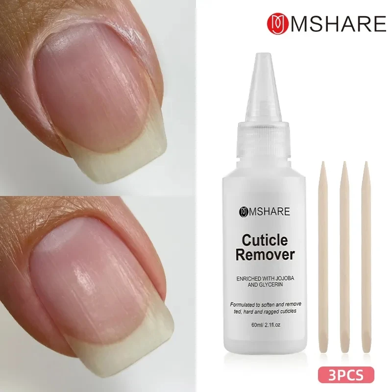 modelones Cuticle Cream, Ultra-Hydrating Cuticle Nail Care Organic Jojoba  Oil Vitamin E Serum, Deep Moisturizing Cuticle Repair Treatment Non-greasy,  Soothe, Repair Dry Cracked Cuticles, 15ML A-Cuticle cream