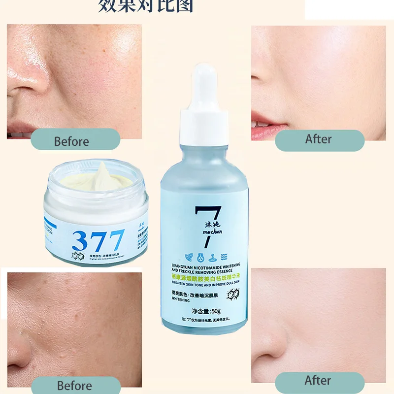 

377 Nicotinamide Whitening and Spot Removing Cream Lightening Skin Tone Nicotinamide Beauty Shop Line Spot Removing face cream