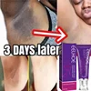 Whitening Cream Private Parts Underarm Bleaching Whiten Butt Knee Brighten Inner Thigh Intimate Parts Dark Remove Melanin Care 1