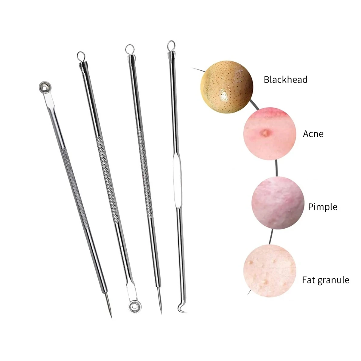 4PCS Acne Blackhead Comedone Black Spot Pimple Blemish Remover Skin Care Needle Facial Pore Cleanser Hook Beauty Cleaning Tool