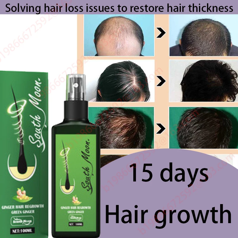 

Fast Hair Growth Ginger Growth Hair Oil Treatment Anti Hair Loss Men Women Scalp Treatment Serum Products Beauty Health