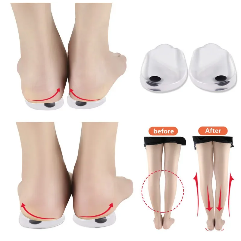 Silicone Gel Orthotic Heel Pad for XO Legs Orthopedic Insoles Varus Correct Plantar Fasciitis Pain Relief Foot Care Insert sport insoles sport orthopedic insoles sports insoles heel insoles orthopedic insoles shoe insoles