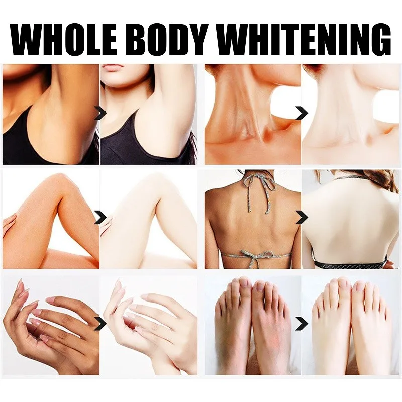 Körperaufhellungscreme, Achseln, Knie, Gesäß, dunkle Haut, Bleichmittel, verbessert die Melaninpigmentierung, stumpf, feuchtigkeitsspendend, erhellt die Hautpflege_voghion.com