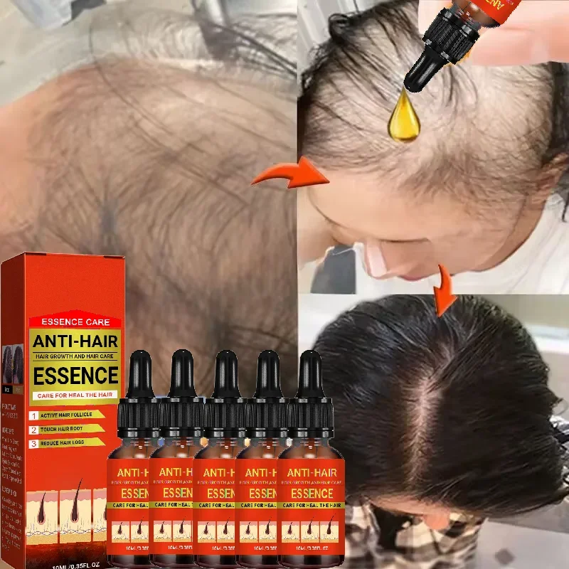 Hair Growth Serum 7 Days Fast Regrowth Essential Capsule Anti Hair loss Baldness Repair Damaged Scalp Treatment For Women Men