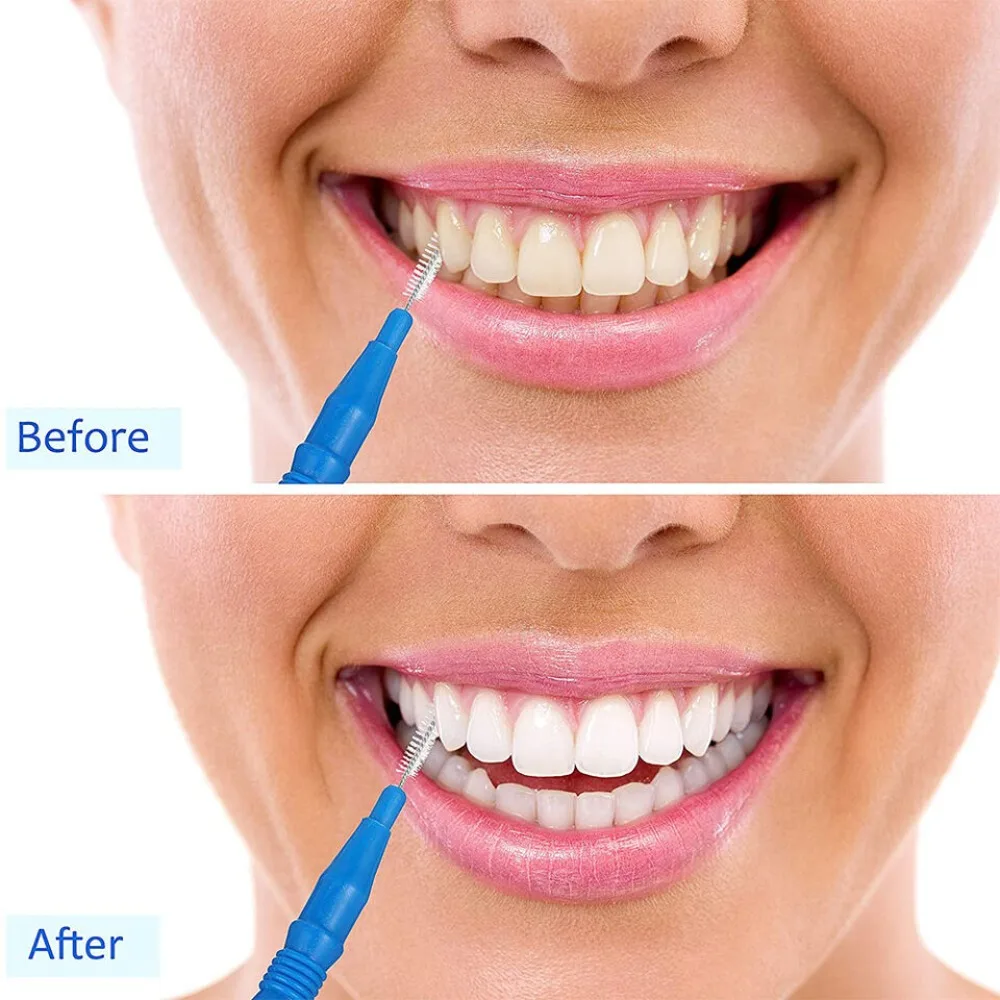 20 개/대 크리 에이 티브 플라스틱 치간 칫솔 구강 위생 치아 깨끗한 이쑤시개 치과 교정 치실 스틱 구강 관리