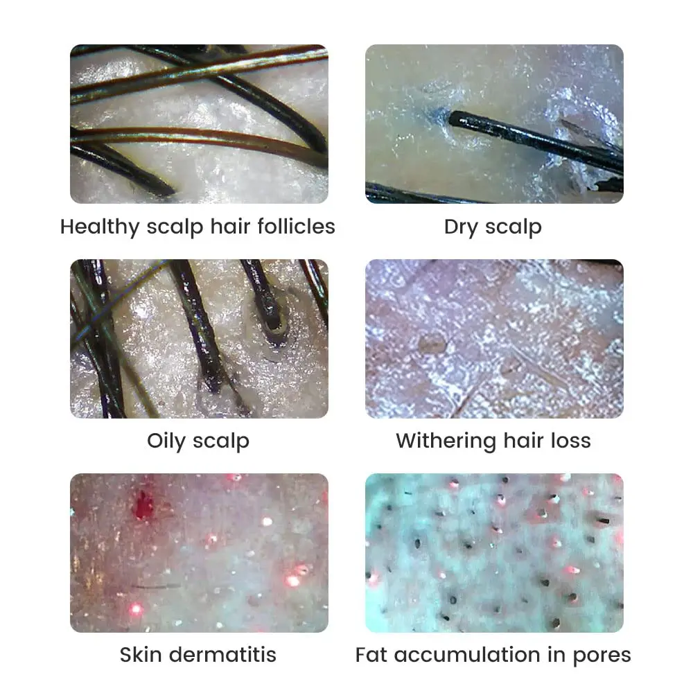 Analizzatore Cutaneo 1000X, Dermatoscopio Wireless, Analizzatore per Viso e Corpo, Microscopio Elettronico Professionale per Bellezza e Salute - immagine 3