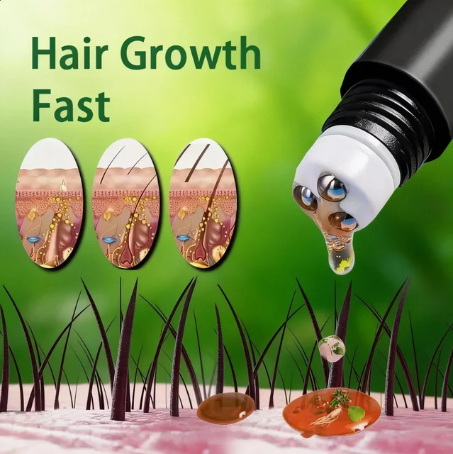 Huile de croissance rapide des cheveux à la biotine, produits de soin, traitements de massage du cuir chevelu, anti-chute de cheveux, sérum efficace pour faire pousser des cheveux plus épais pour hommes 1