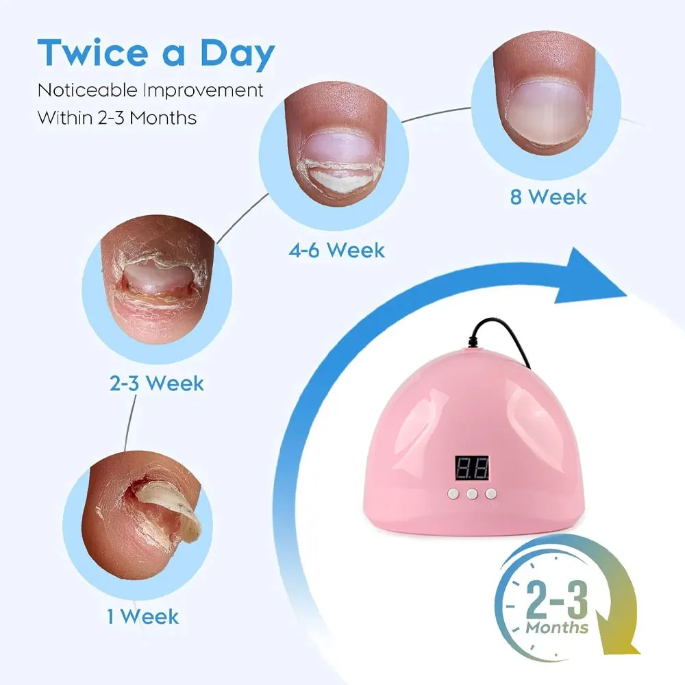 Fungal Nail Laser Device Fast Repair Nails Fungus Onychomycosis Toenail Fingernail Removes Nail Fungus Foot Care Cure Ingrown