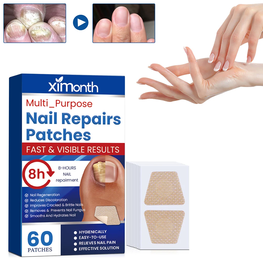Toenail Fungus Foot Care Patches 60Pcs Waterproof Nail Repair Ingrown Correction Stickers Discolored Damaged Nails