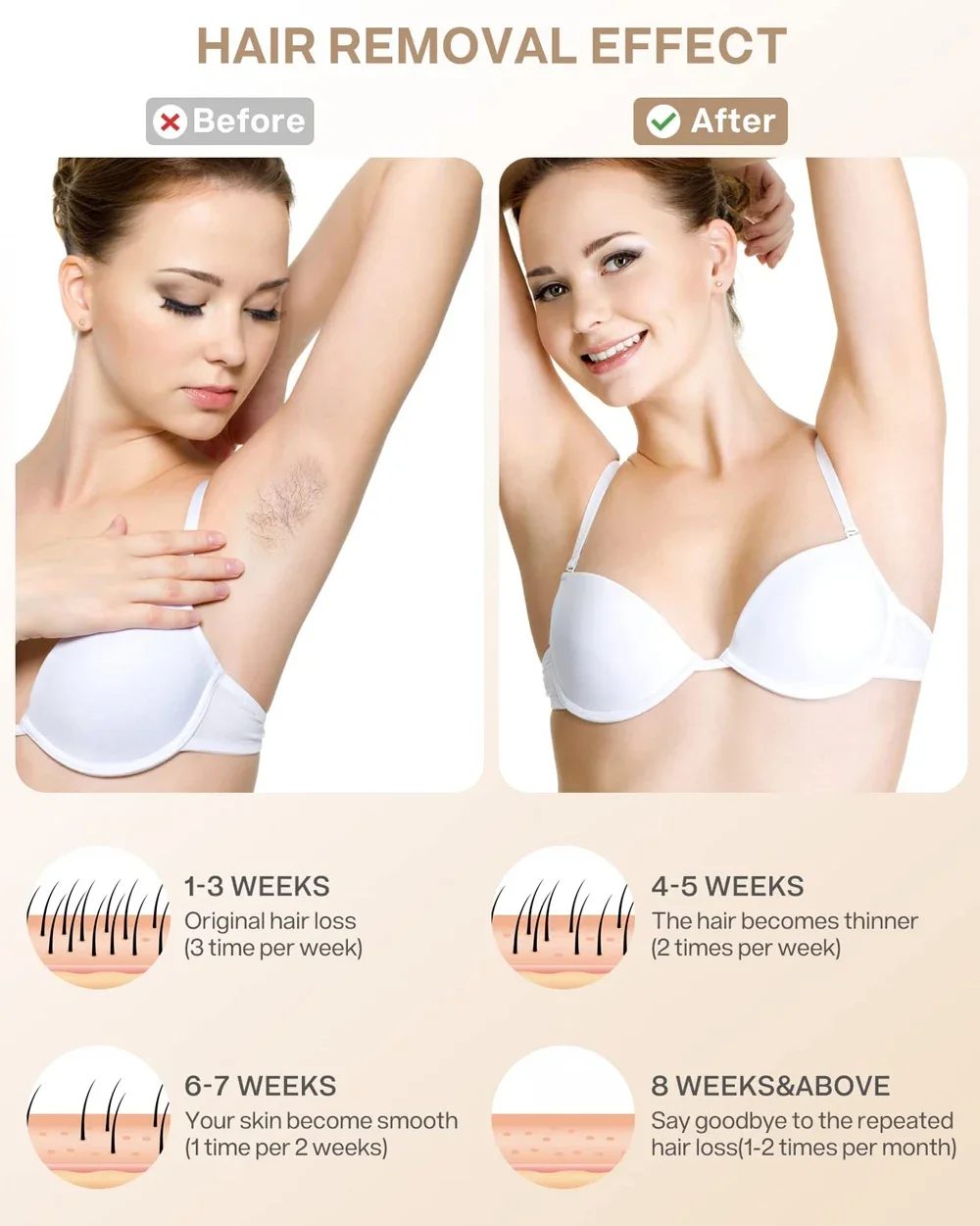 Mijia ipl permanent laser hårborttagning smärtfri epilator_voghion.com