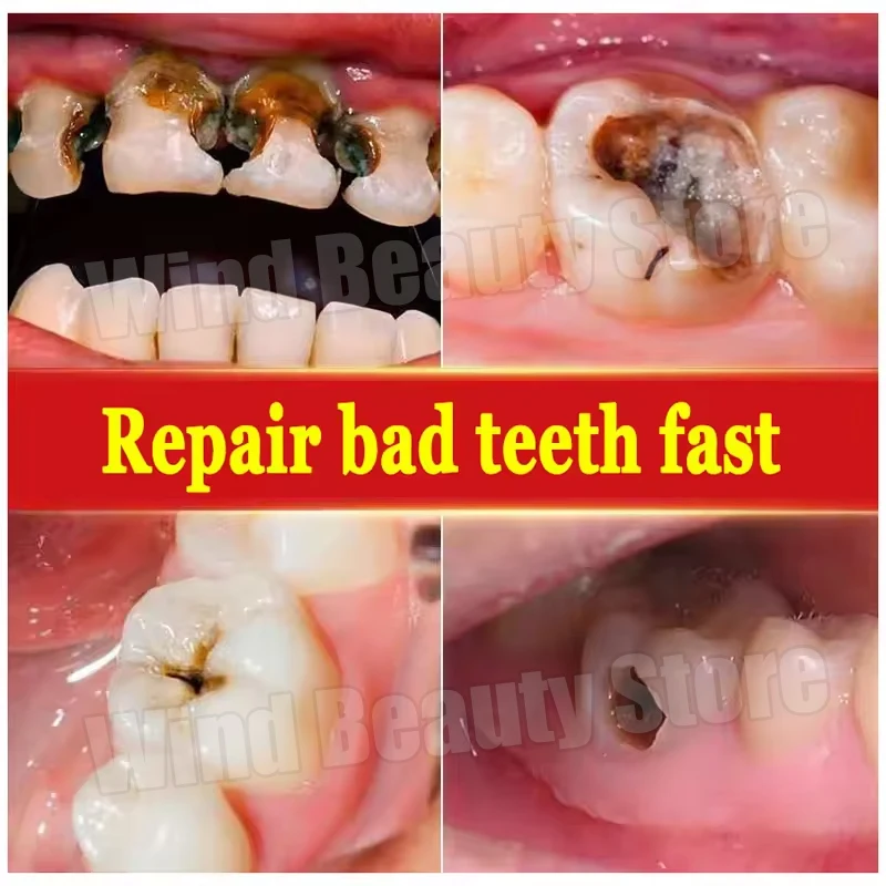 120g Probiotic Caries Toothpaste SP 4 Whitening Tooth Decay Repair Paste Teeth Cleaner Plaque Remover Fresh Breath Dental Care