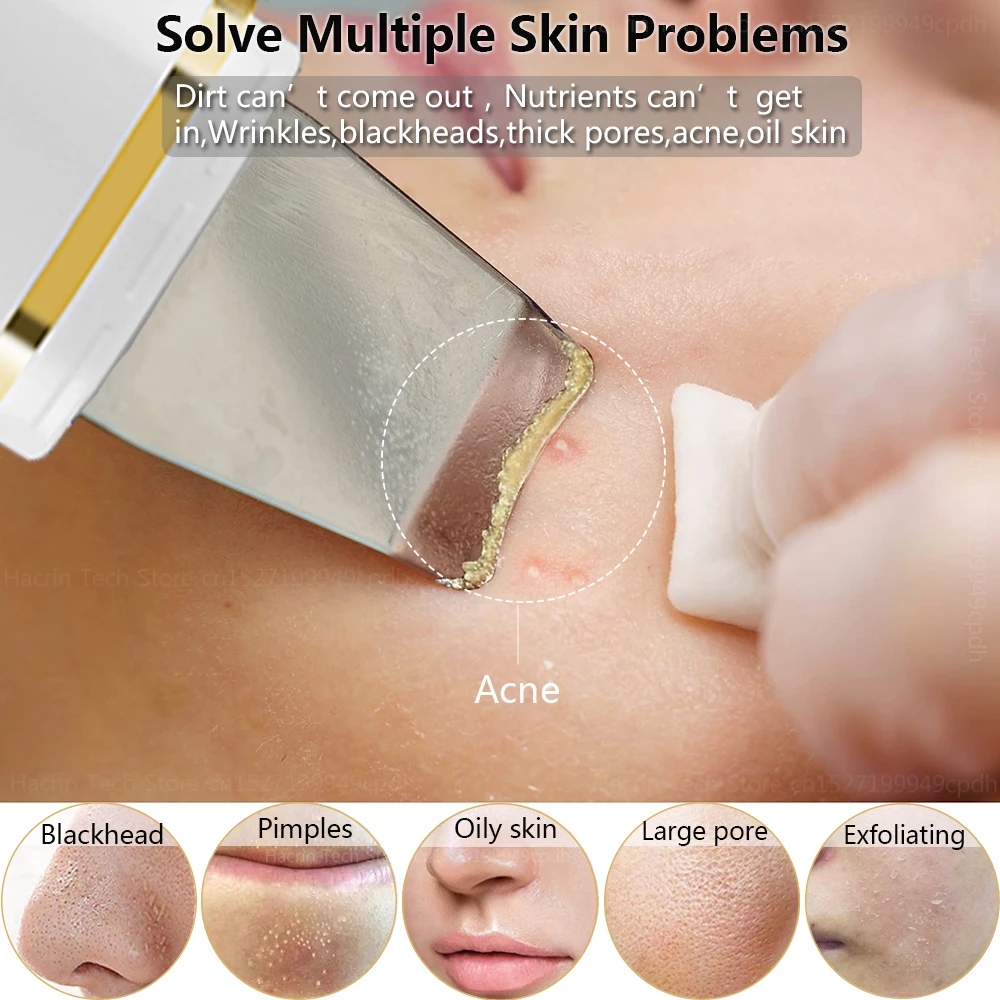 Ultrasonic Skin Scrubber Remover Blackhead Ultrasonic Peeling Facial Scrubber Shovel Ion Deep Cleaning Remove Pore Acne Cleanser