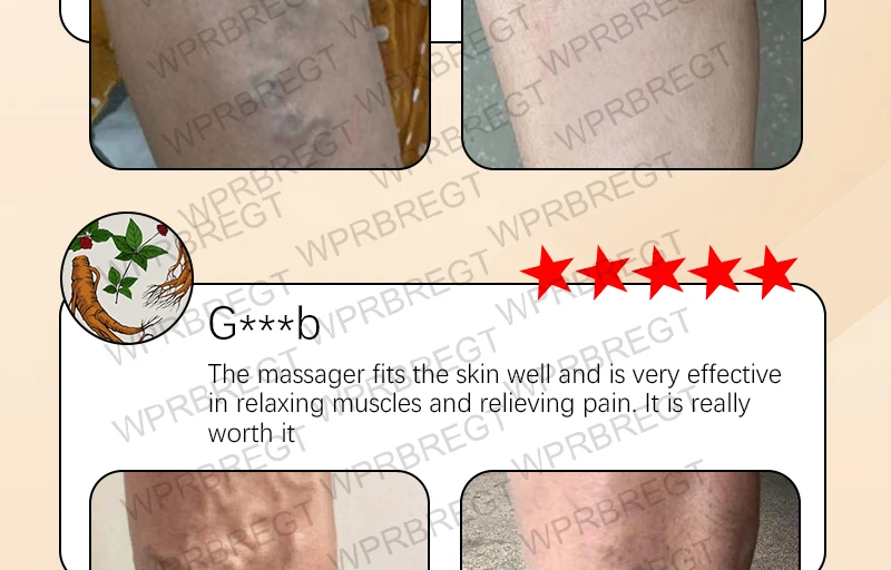 Pulse Massage Patch Eliminates Varicose Veins And Effectively Improves Blood Circulation_voghion.com