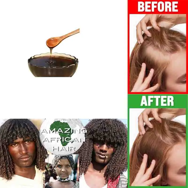 Naturally Regrow Hair Postpartum Hair Loss Treatment Using South African Tribal Herbal Shampoo Stop Hair Fall Keratin Supplement bio groom herbal groom shampoo шампунь для собак кондиционирующий 355 мл