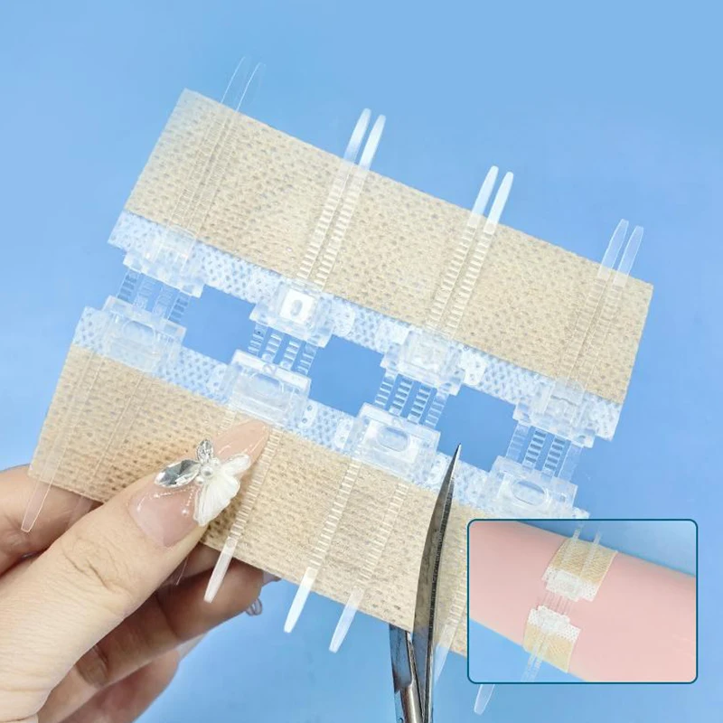 Portable Zipper Tie Wound Closure Patch Hemostatic Patch Wound Fast Without Suture Zipper Outdoor Band-Aid Quick Clot