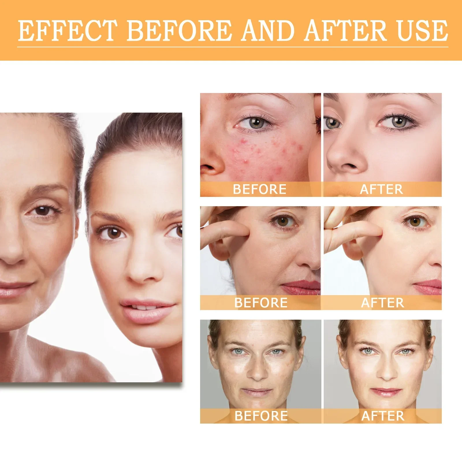 100ml EELHOE Original Glycolic Acid Lotion Acne Removing Closed Mouth Hydrating Moisturizing Shrink Pores Brighten Skin Color