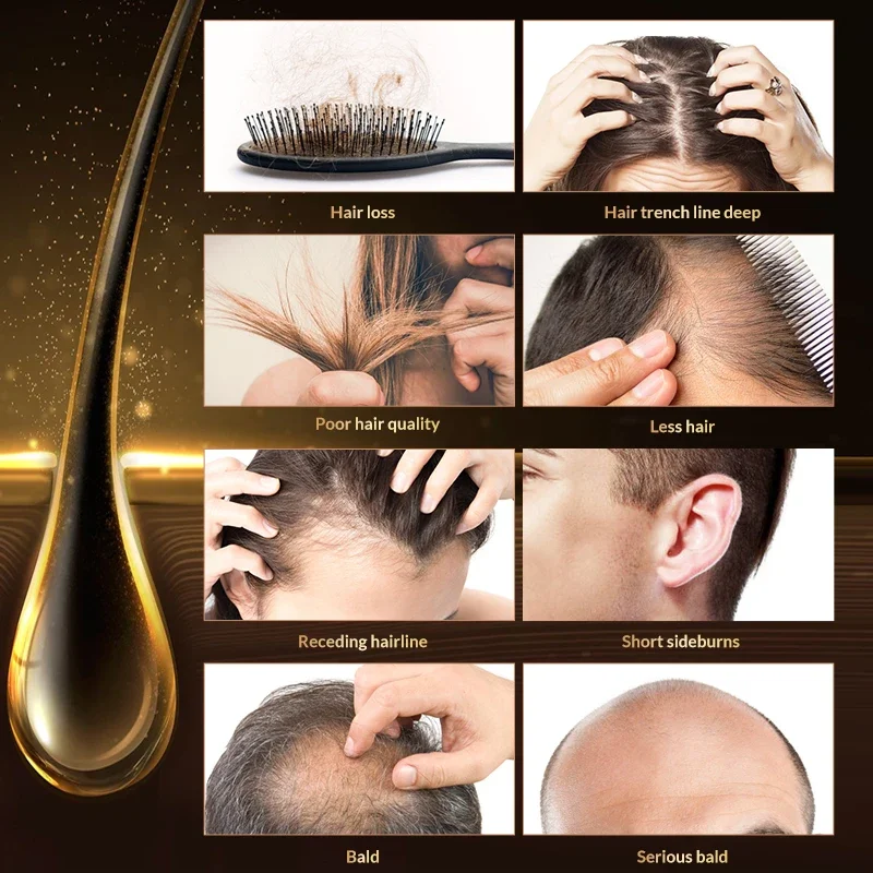 Hair Fibers Keratin Topic Thickening Spray Hair Building Fibers 27.5g Loss Products Instant Regrowth Powders Growth Product hair building powder hair building fibers hair growth spray