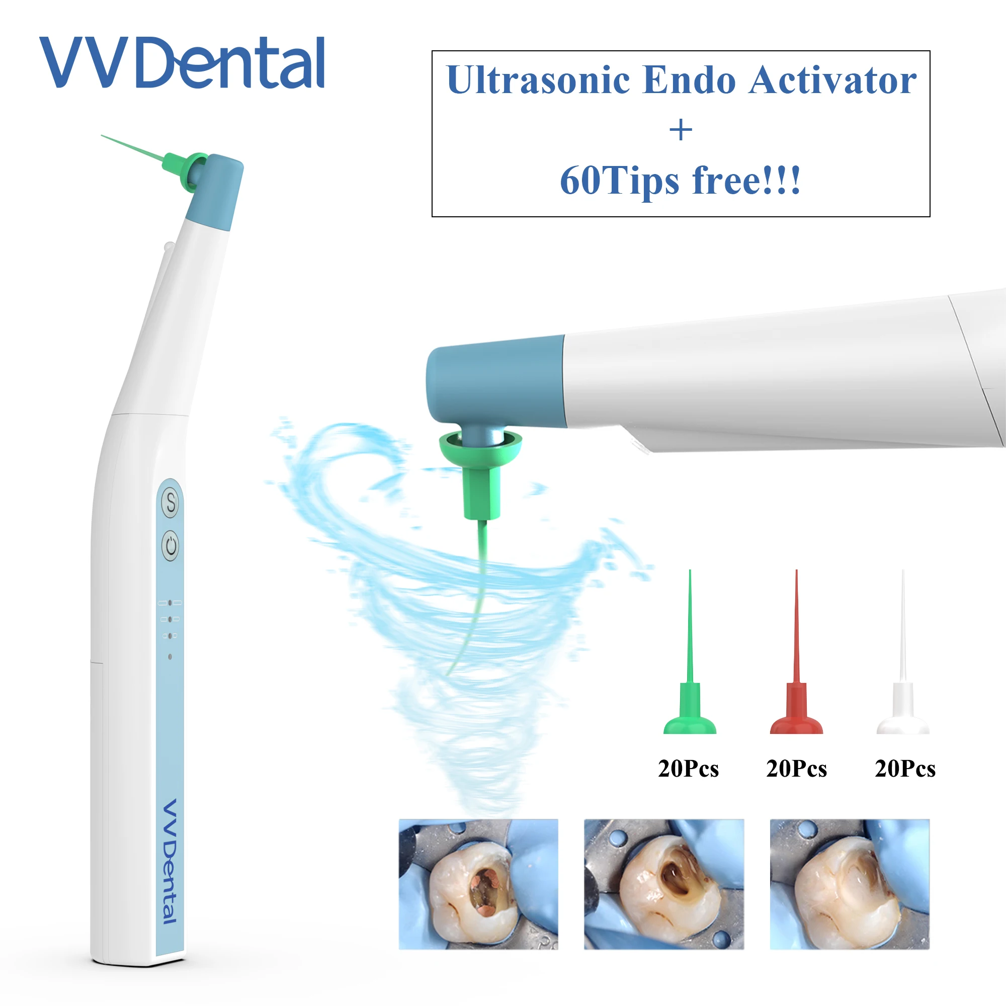 VV Dental New Oral Sonic Irrigator With 60 PCS Tips For Root Canal