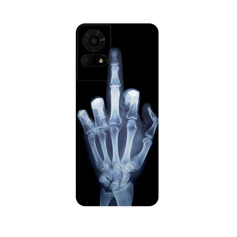Cartoon Printed Soft TPU Silicone Back Cover - Bumper Case