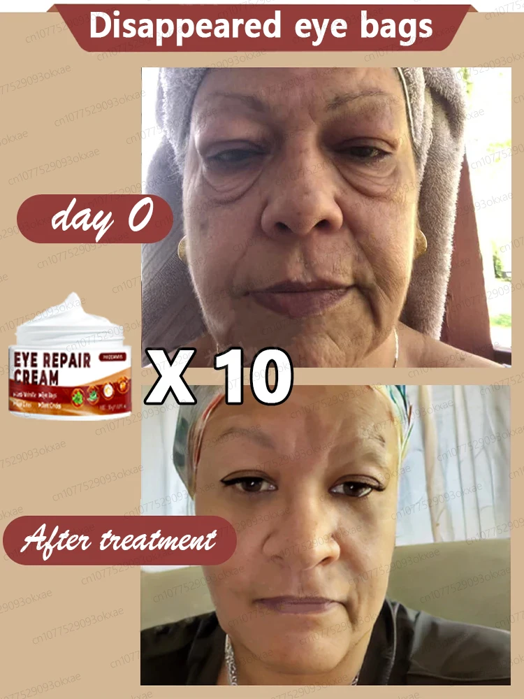 Eye cream eliminates puffiness dark circles eye bags moisturizes repairs healthy eyes eye cream