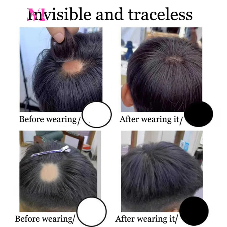 Brown Human Hair Wig Capillary Prosthesis For Male Forehead