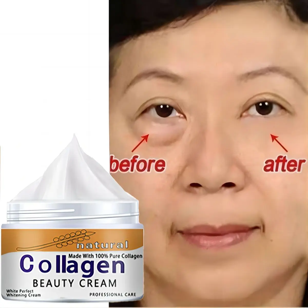 French Snail Hyaluronic Acid Face Cream Wrinkle Cream Improve Cracked Dry Rough