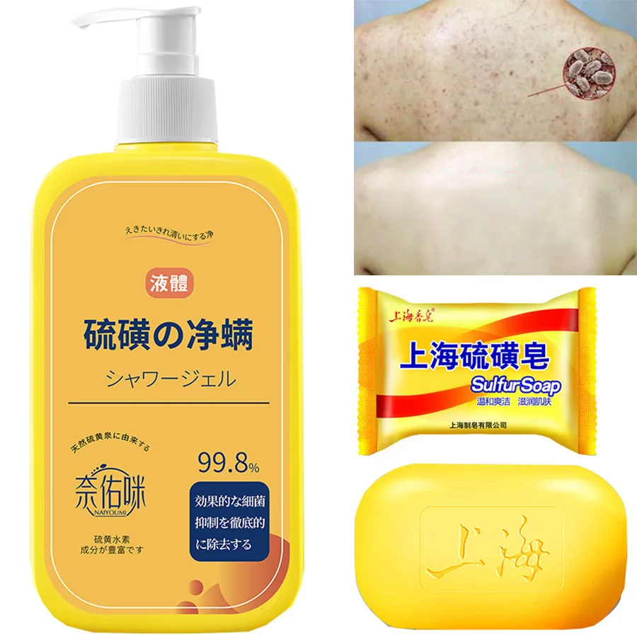 Shower Gel 400ml Sulfur Liquid Mite Removal Soap Cleaner Bar Soap Acne Treatment Reduce Oil Keeps Pores Cleaner Hand Sulfur body wash
