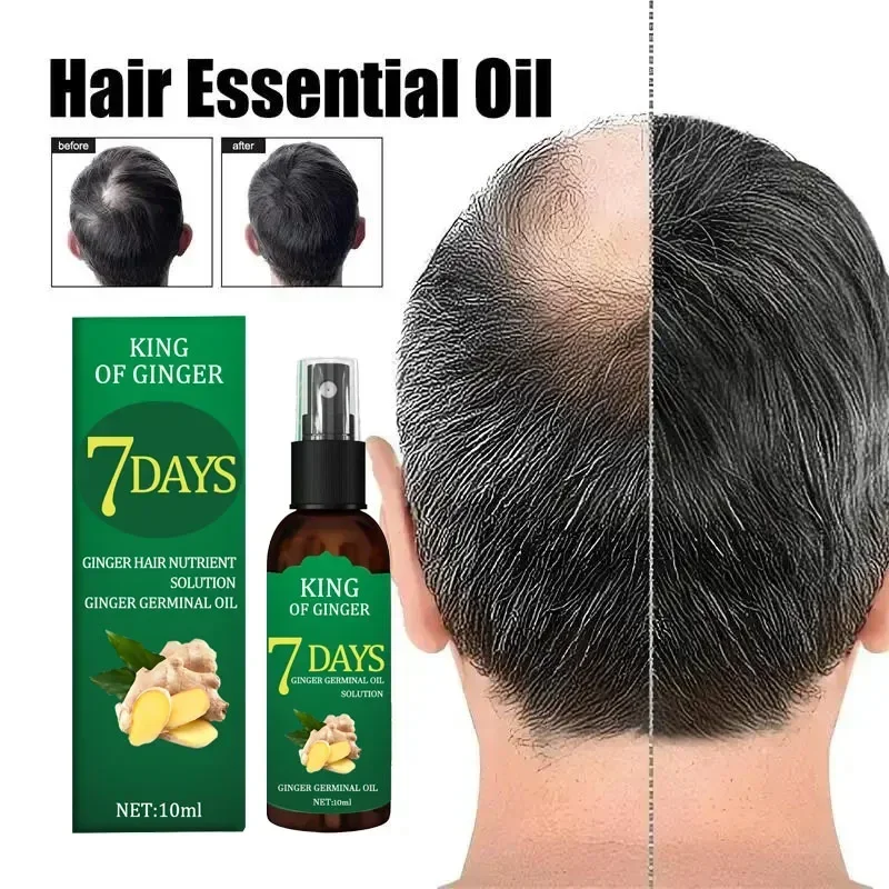 Baldness Hair Loss Care Solution Postpartum Hereditary Follicles