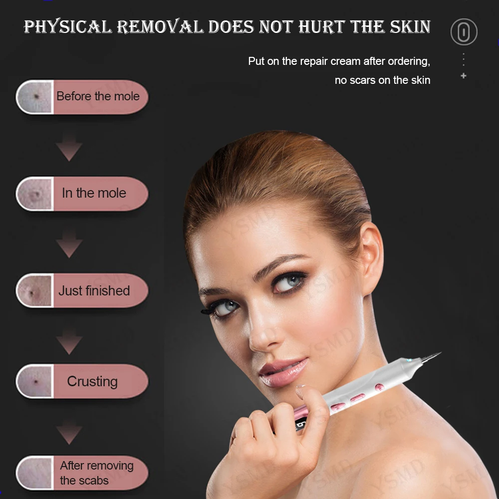 Warts Mole Remover Pen For Skin Face Black Dot Pimples Tattoo Removal Pen Home Beauty Care Tools Facial Beauty-health Device skin tag removal tool skin tag removal pen