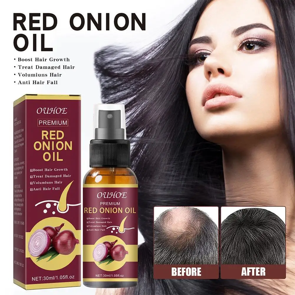 OUHOE Red Onion Essential Oil Spray Extract Strong And Moisturized Hair For Hair Care And Growth Prevent Loss