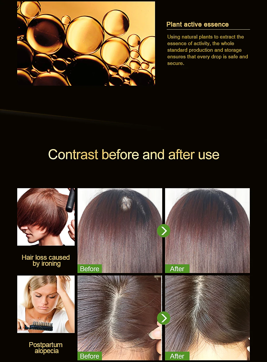 Extrato de Gengibre Crescimento do Cabelo Perda de Cabelo Cuidados com o Cabelo Andrea Cabelo Denso Rápido Sunburst Essência Restauração Líquido Soro Óleo 1 Pçs 20ml 19 Computers & Electronics