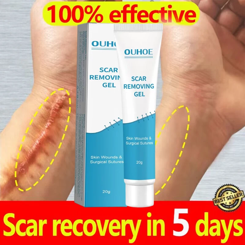 

5-Day Recovery Scar Cream Fast Removal Skin Scars Treat Surgery Scars Stretch Marks Acne Pox Prints Burn Repair Facial Care Gel