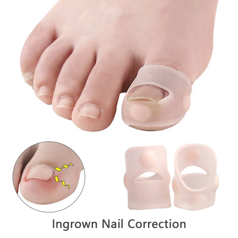 1pair Invisible Ingrown Toe Nail Treatment Silicone Ingrown Toenail Correction Tool Elastic