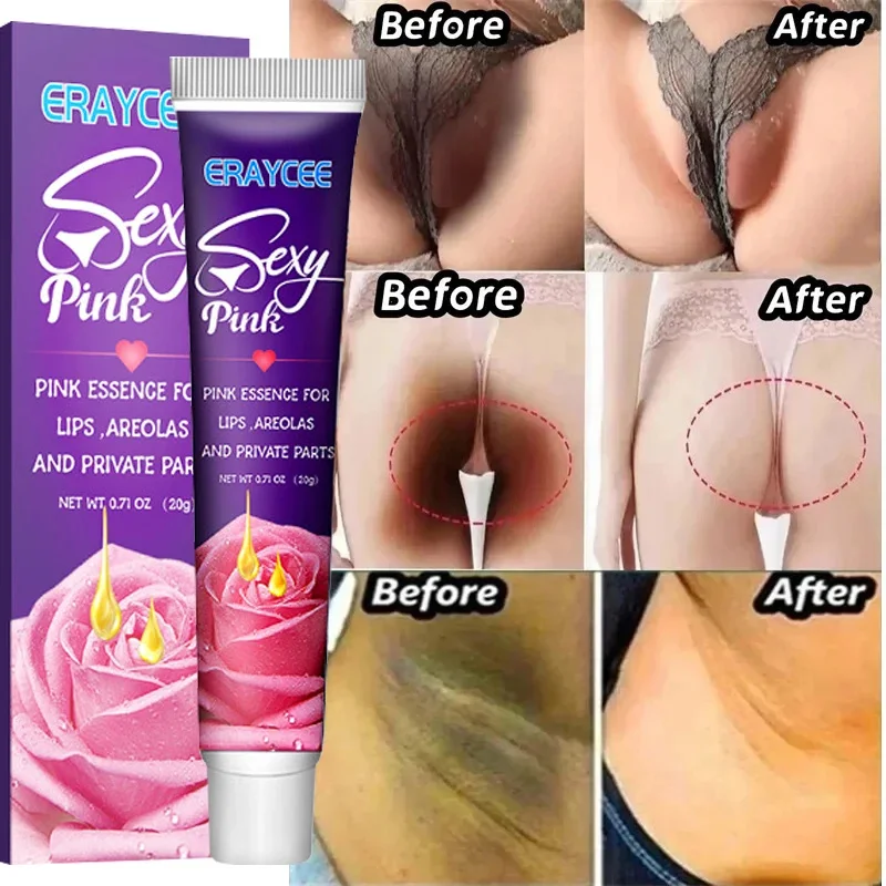 Whitening Cream Private Parts Underarm Bleaching Whiten Butt Knee Brighten Inner Thigh Intimate Parts Dark Remove Melanin Care body whitening cream intimate areas underarm knee buttocks private bleach remove melanin pigmentation nourish dark skin brighten