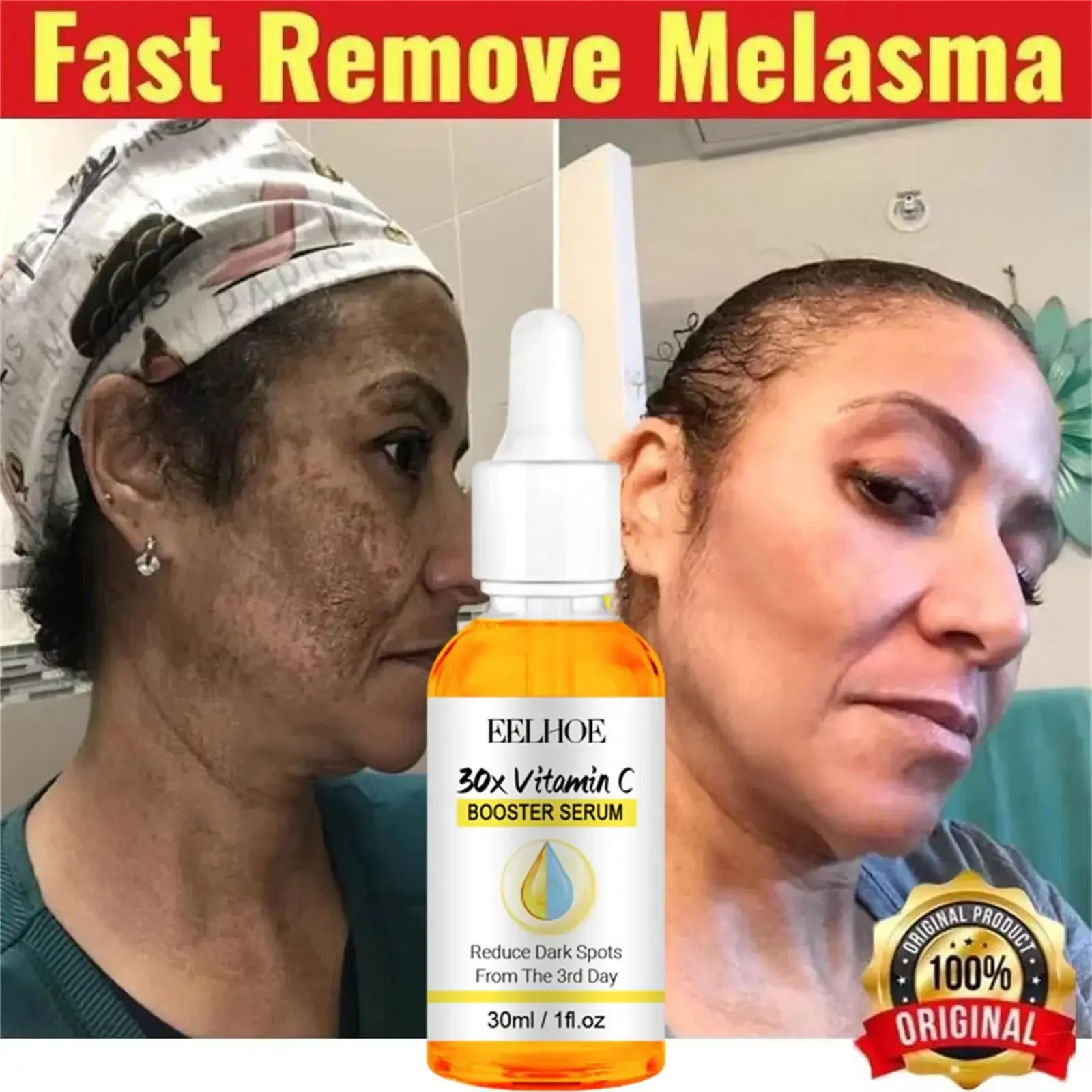 Whitening Freckles Face Serum Effective Remove Dark Spots Fade Melanin Improve Dullness Brighten Repairing VC Skin Care Product