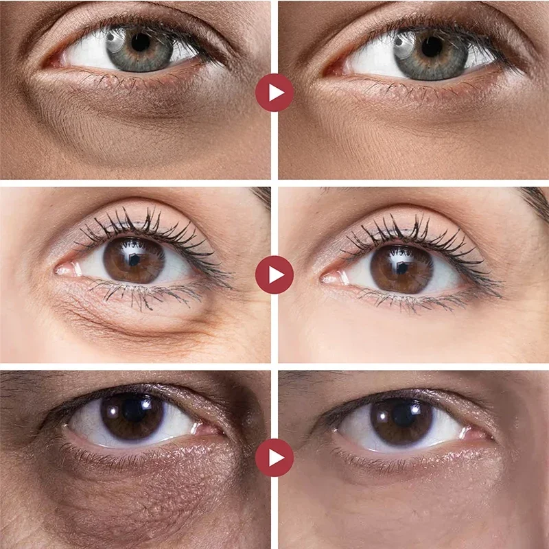 Anti Wrinkle Eye Cream Eye Cream Peptide Eye Bags Eye Cream Anti Dark Circle Hyaluronic Acid Wrinkle Removal Cream Roller Massager Skin Care Beauty