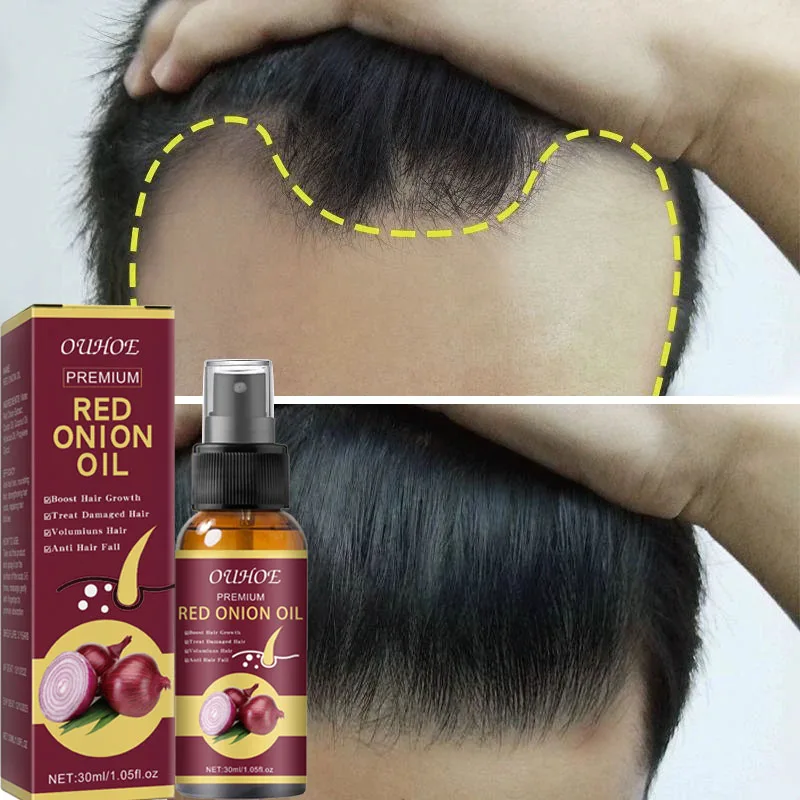 

Powerful Hair Growth Serum Spray Anti Hairs Loss Treatment Essence Repair Nourish Roots Regrowth Hair Care Product For Men Women