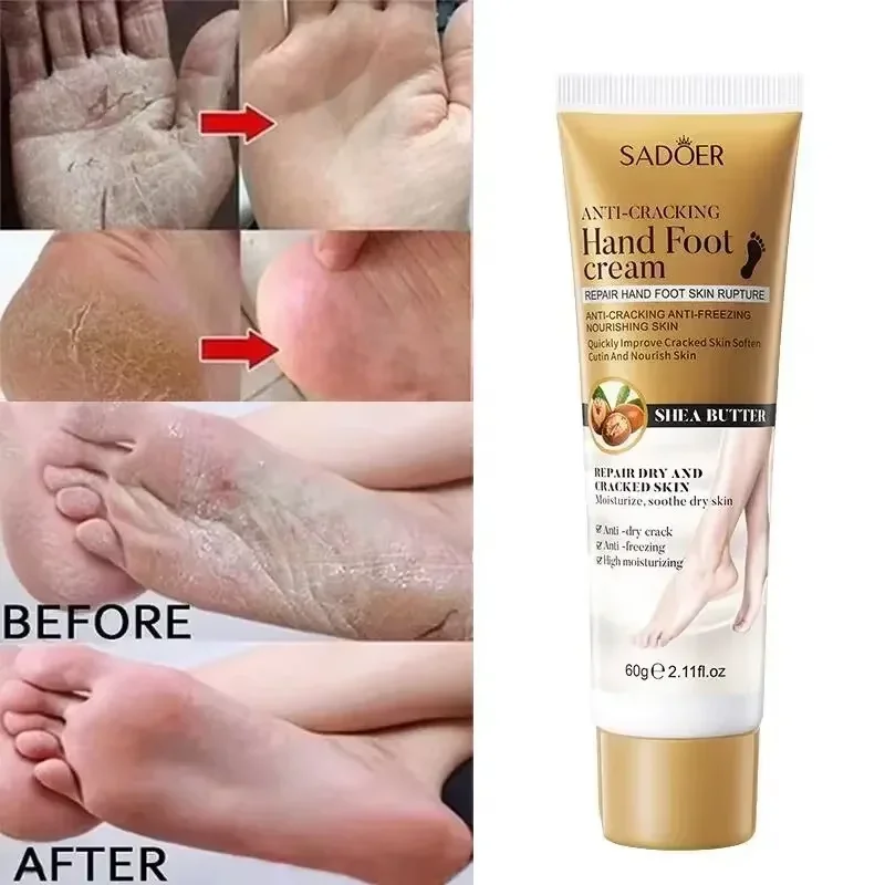60g Collagen Anti-drying Cracked Foot Cream Remove Wrinkle Callus Rough Whitening Moisturizing Soft Tender Hand Foot Skin Care 2