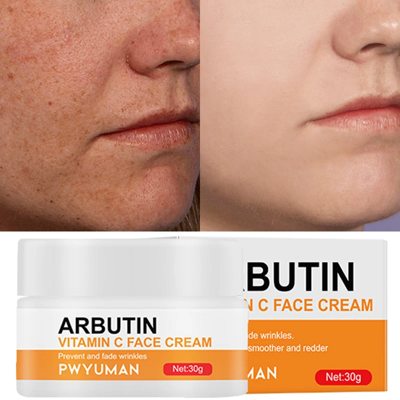 

Vitamin C Whitening Face Cream Remove Dark Spots Reduce Fine Lines Shrink Pores Brightening Moisturizing Beauty Care Products